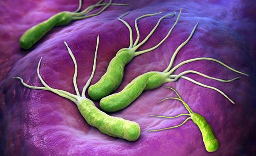 Dyspepsia and the Impact of H. pylori