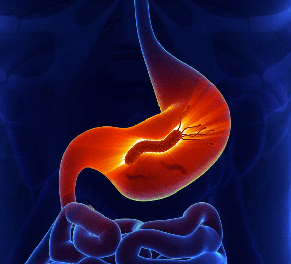 How h. pylori may influence vitamin B12 absorption