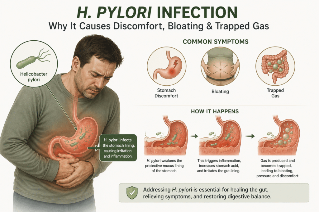 Digestive bloating and excess gas associated with H. pylori-related stomach irritation.