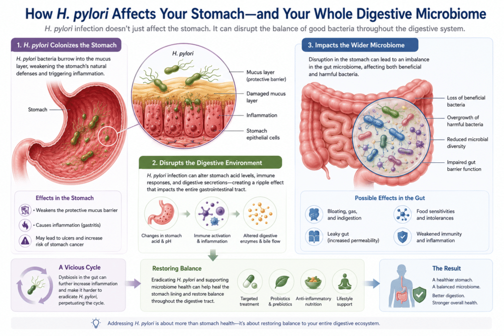 Healthy gut balance compared with gut dysbiosis.