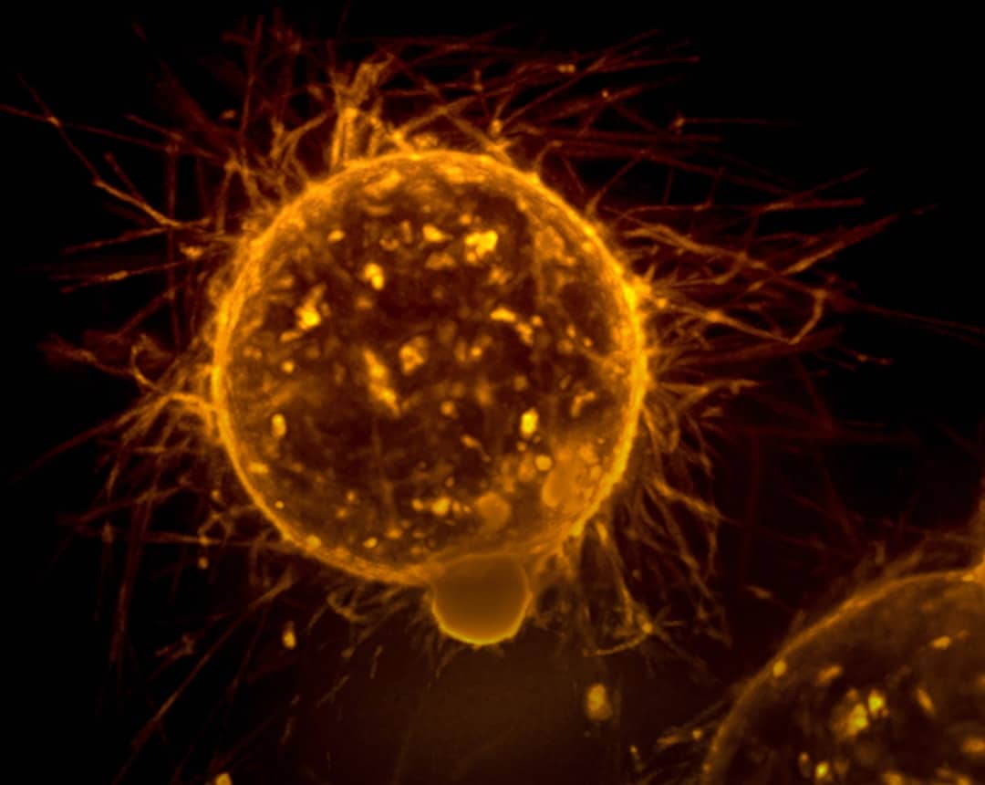 Understanding how chronic H. pylori irritation may affect stomach tissue over time